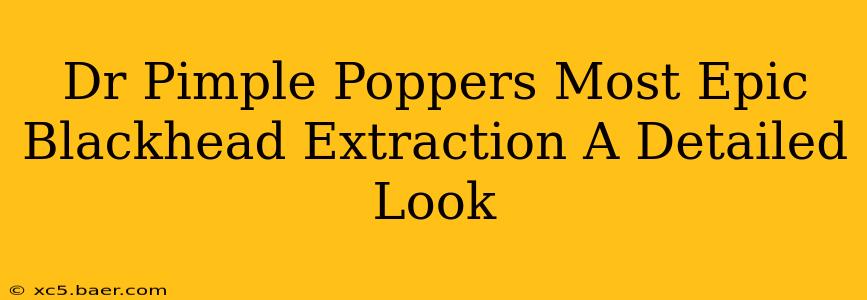 Dr Pimple Poppers Most Epic Blackhead Extraction A Detailed Look