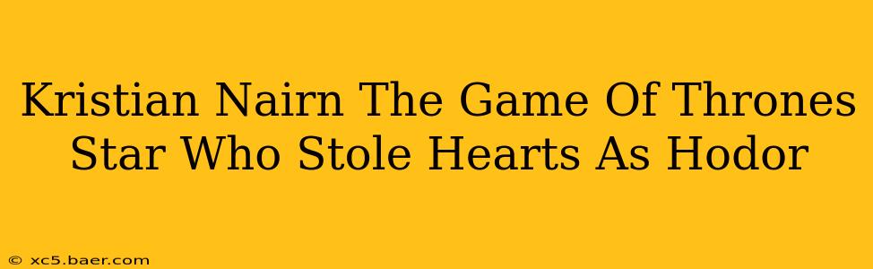 Kristian Nairn The Game Of Thrones Star Who Stole Hearts As Hodor