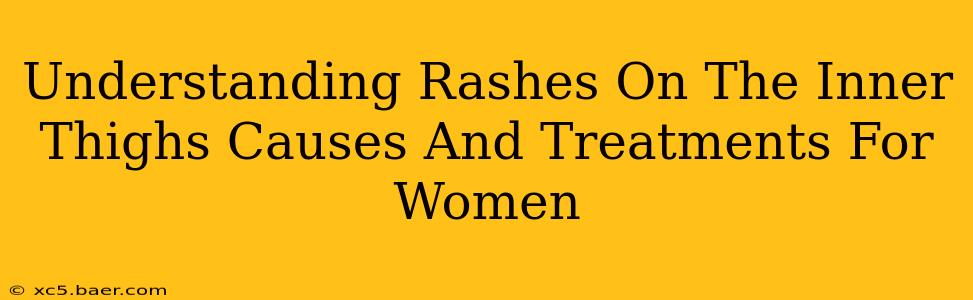 Understanding Rashes On The Inner Thighs Causes And Treatments For Women