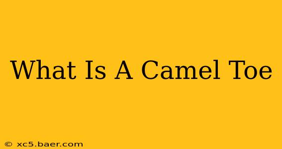 What Is A Camel Toe